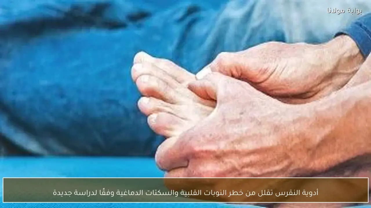 أدوية النقرس تقلل من خطر النوبات القلبية والسكتات الدماغية وفقًا لدراسة جديدة