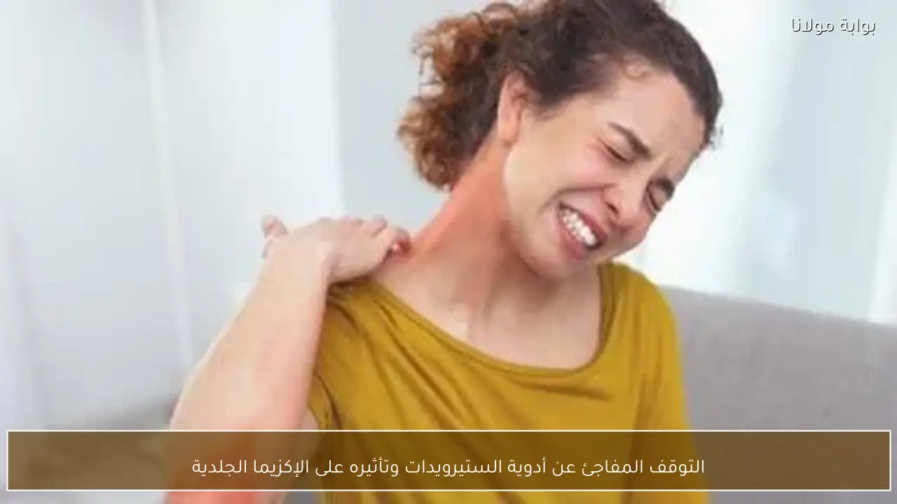 التوقف المفاجئ عن أدوية الستيرويدات وتأثيره على الإكزيما الجلدية