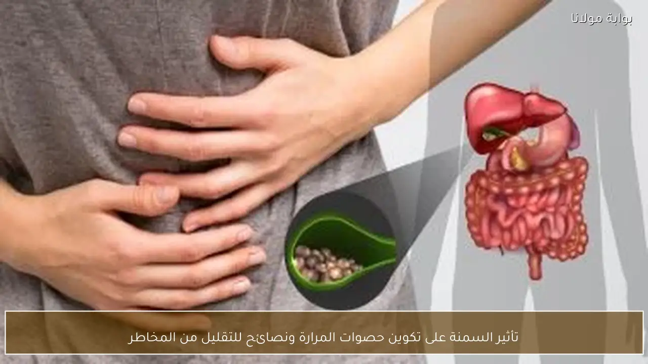 تأثير السمنة على تكوين حصوات المرارة ونصائح للتقليل من المخاطر