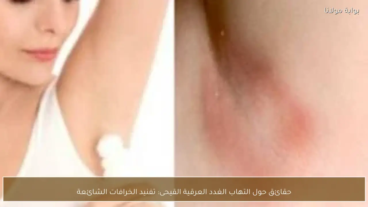 حقائق حول التهاب الغدد العرقية القيحى: تفنيد الخرافات الشائعة