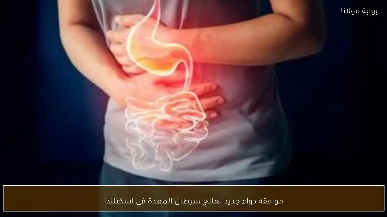 موافقة دواء جديد لعلاج سرطان المعدة في اسكتلندا