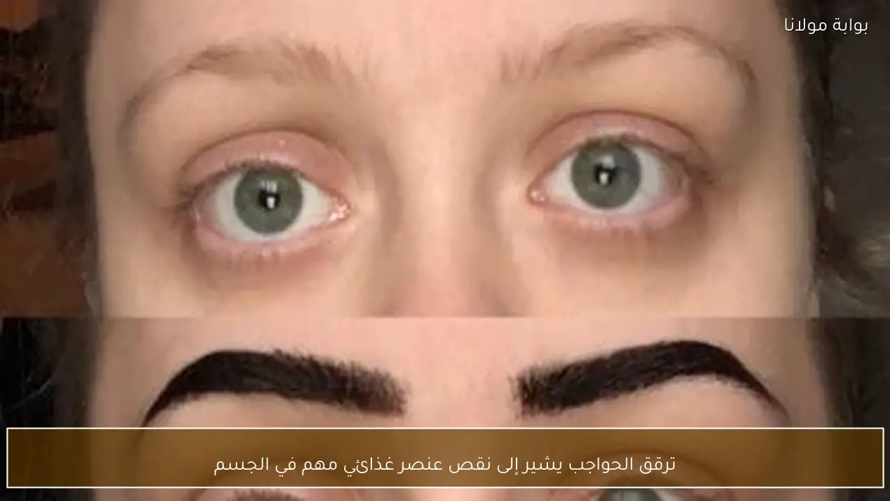 ترقق الحواجب يشير إلى نقص عنصر غذائي مهم في الجسم