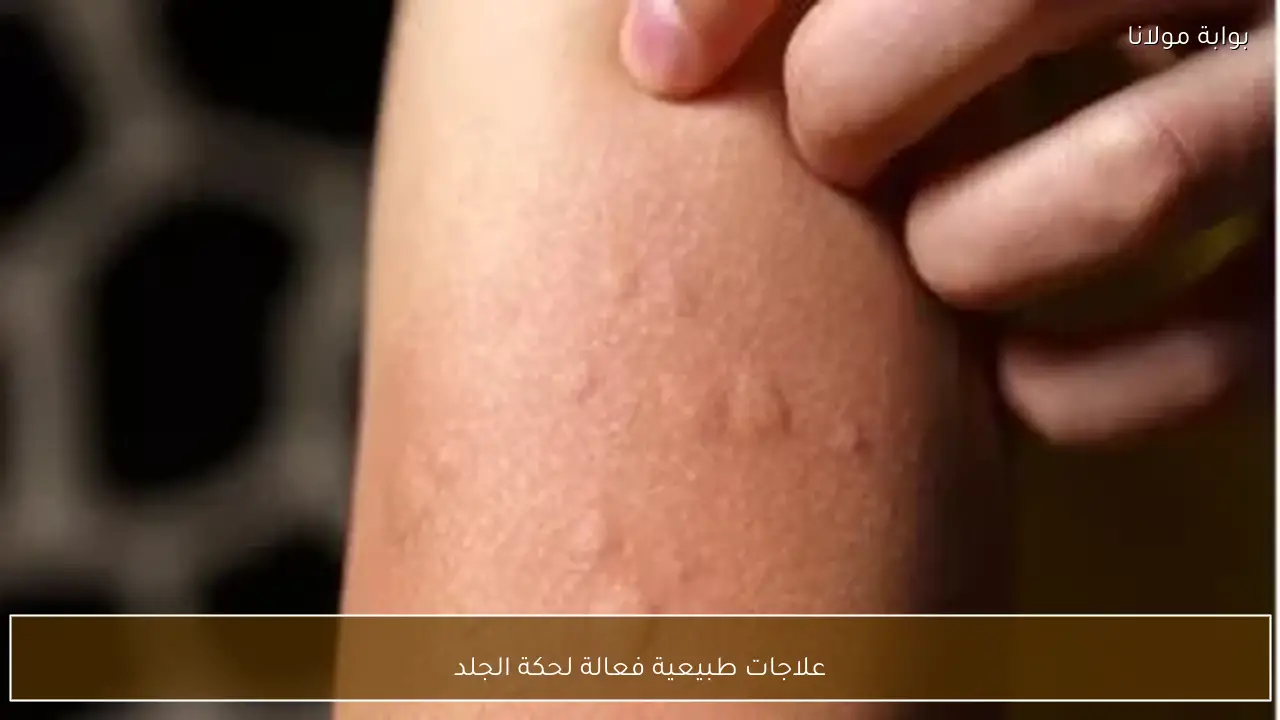 علاجات طبيعية فعالة لحكة الجلد